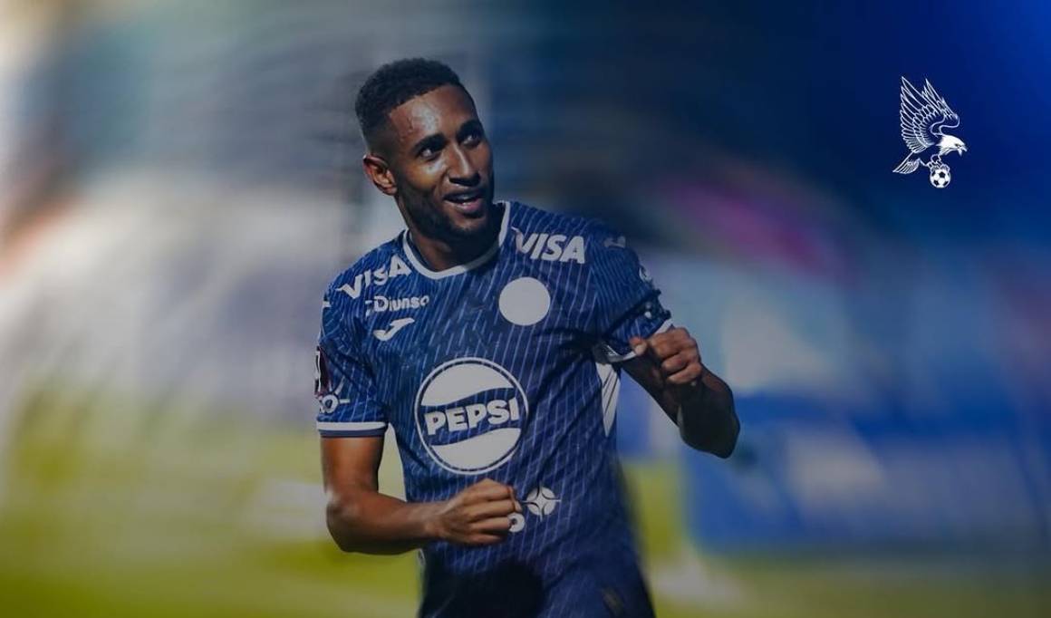 ¡HORROR EN LA CANCHA! 🚨 Romario Da Silva sufre FRACTURA BRUTAL en Honduras